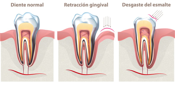 Como utilizar hilo dental