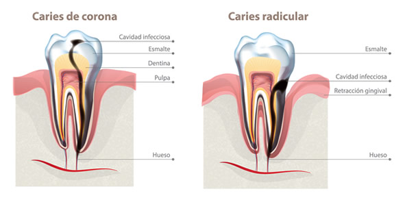 Como utilizar hilo dental