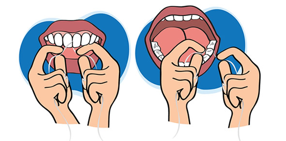 Hilo dental